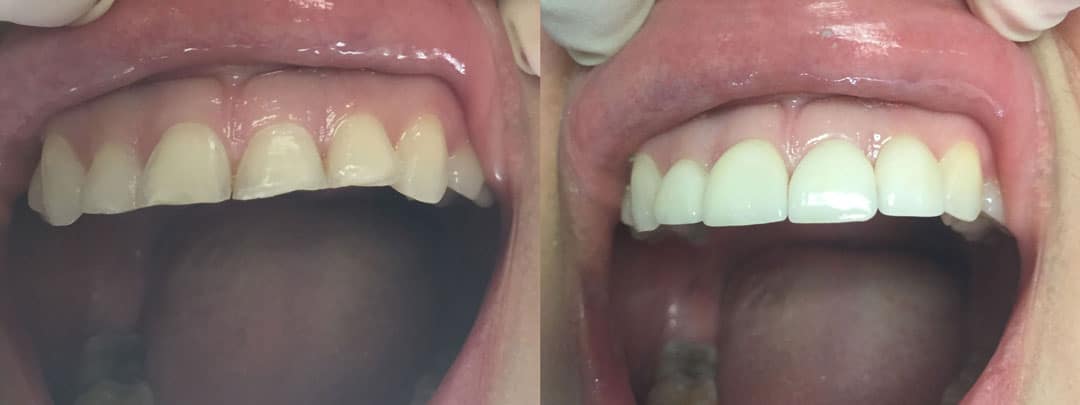 Romeoville Dentist